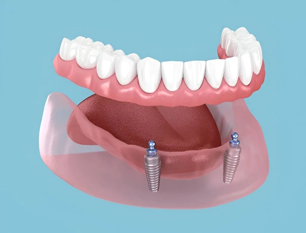 full & partial dentures neaer you