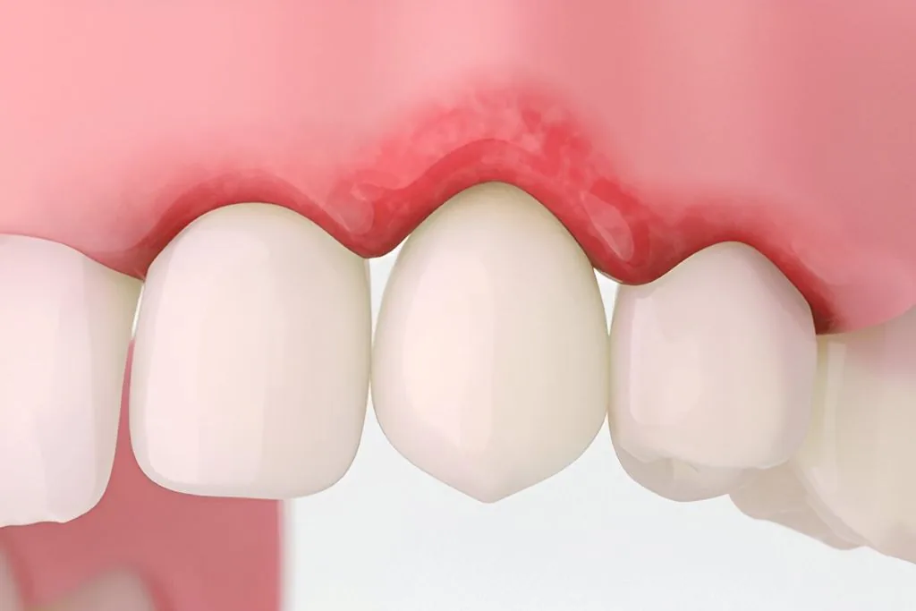 gum disease treatment near you