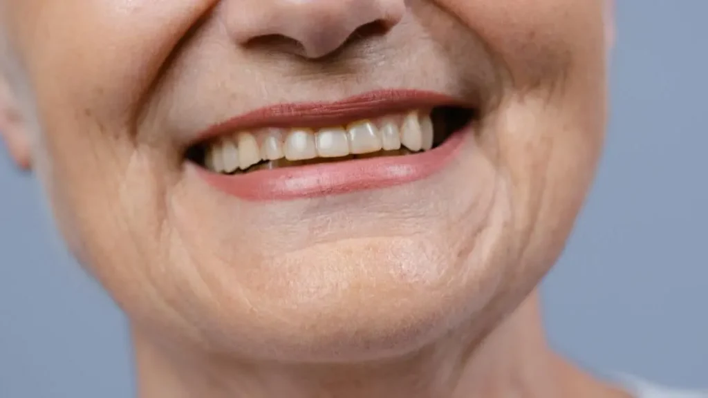 Composite Bonds for Teeth: What They Are and Benefits