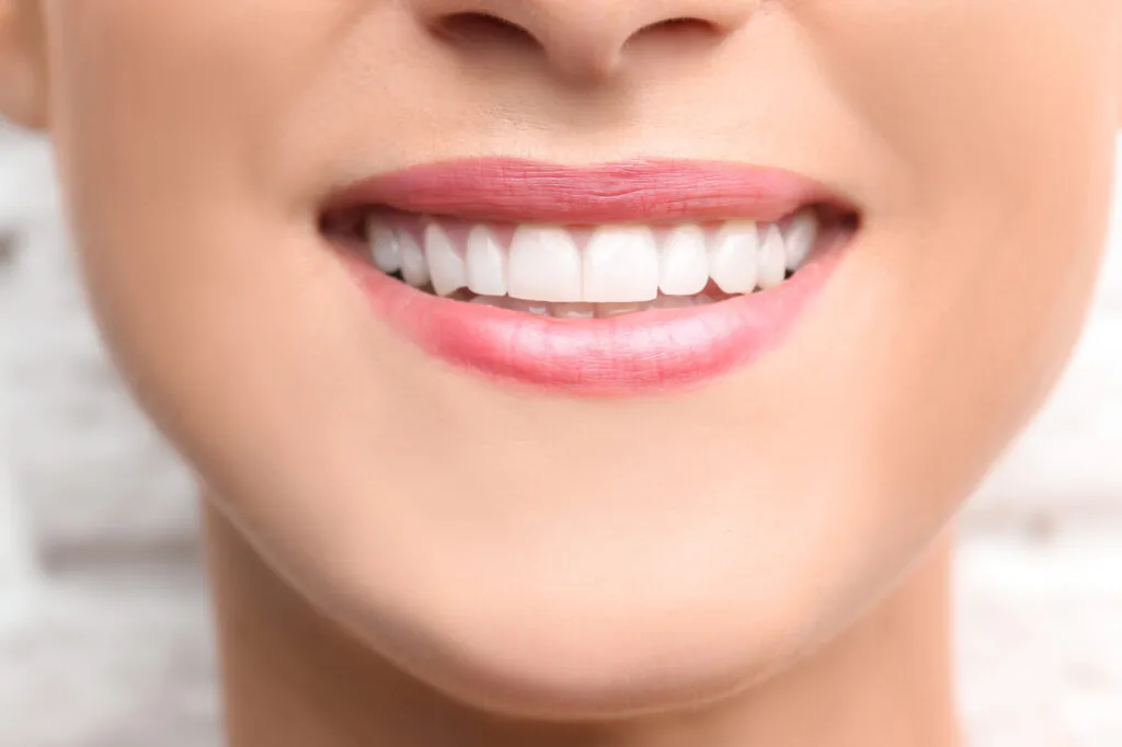 teeth bonding near you