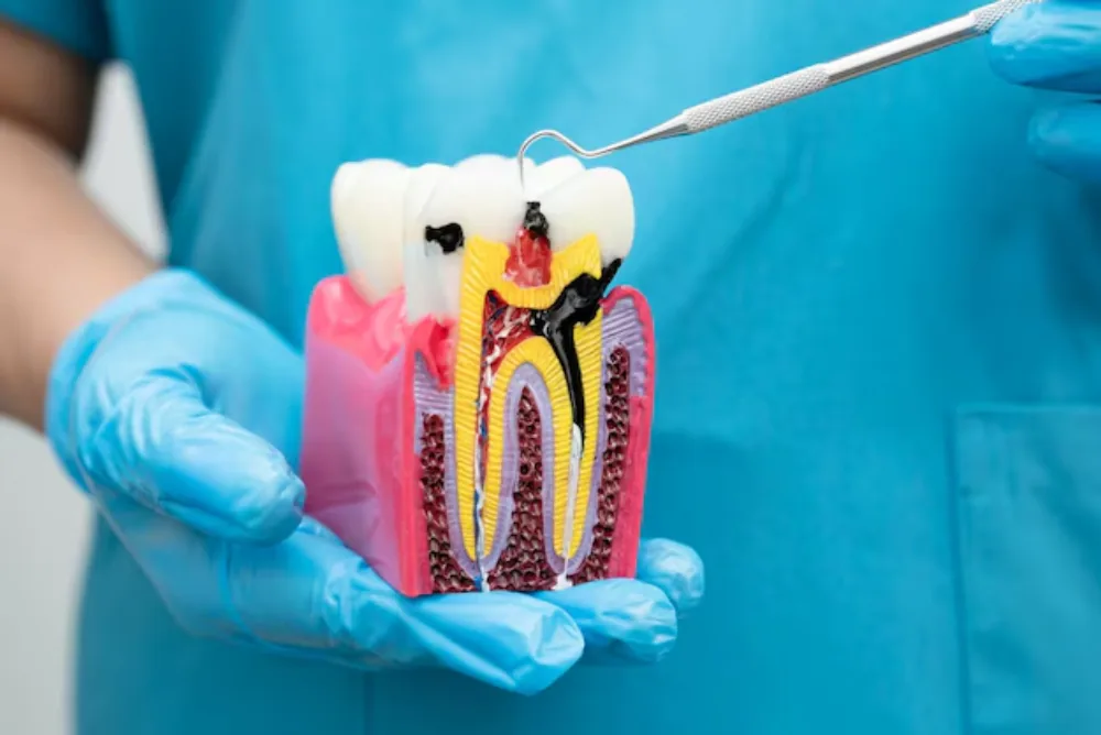 Restore tooth health with root canal treatment in Cookstown, Innisfil. Our team provides precise, caring root canal treatment near you.