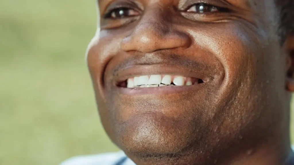 Teeth Composite Bonds: What They Are and Benefits