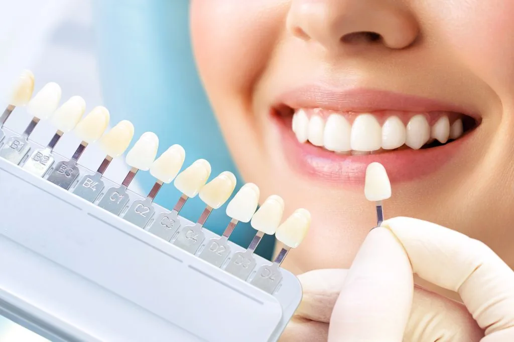 porcelain veneers near you