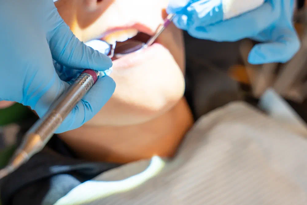 Professional teeth cleaning at Cookstown Dental Centre