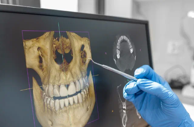 A patient receiving a CBCT 3D dental scan