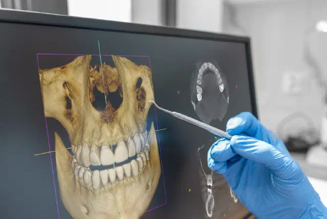 CBCT 3D scanning technology in Cookstown