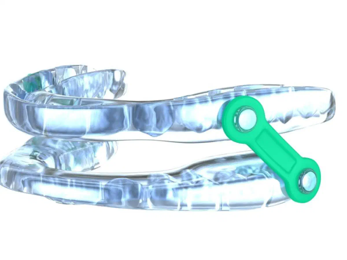 A custom oral appliance used in sleep apnea care