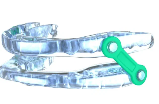 A custom oral appliance used in sleep apnea care