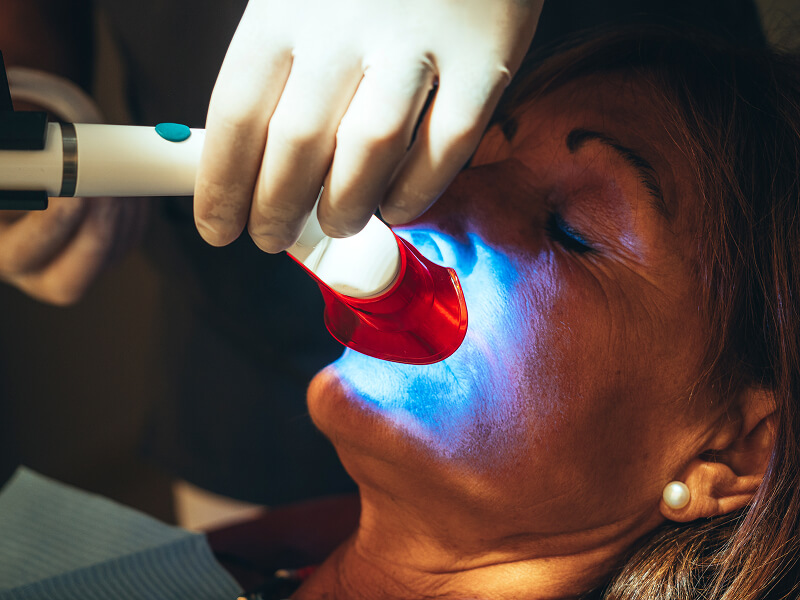 Professional Teeth Whitening