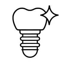Illustration of a dental implant replacing a missing tooth