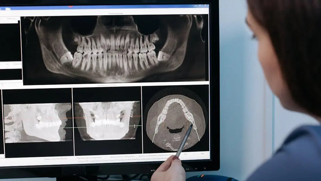 Dentist reviewing X-rays at Comfort Dental closest to me office for patient care